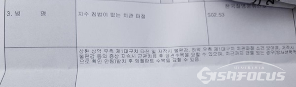 의사가 A씨의 치아를 보고 낸 소견 (사진 / 시사포커스DB)