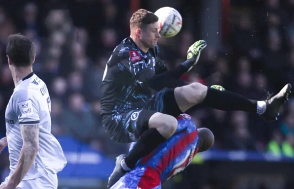 장-필리프 마테타, 상대팀 골키퍼에 얼굴 걷어차이는 부상에서 회복 중. ⓒ BBC